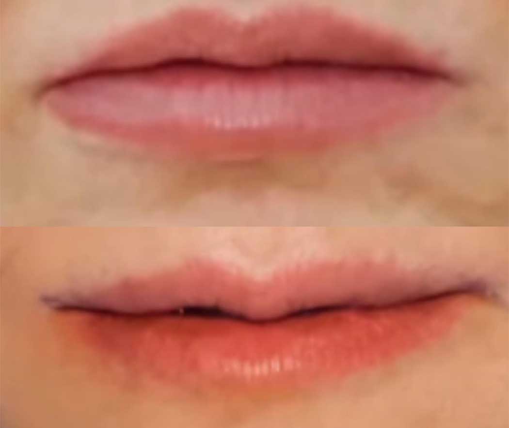 Corner Lips