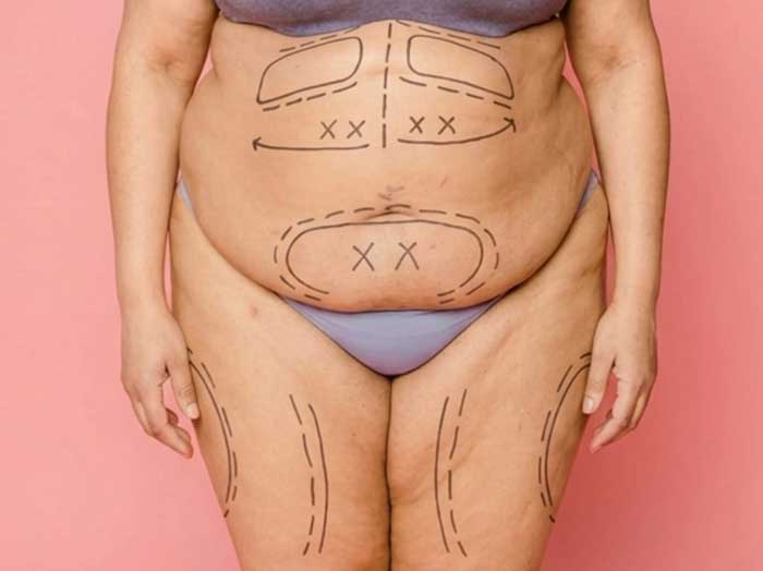 Slimming